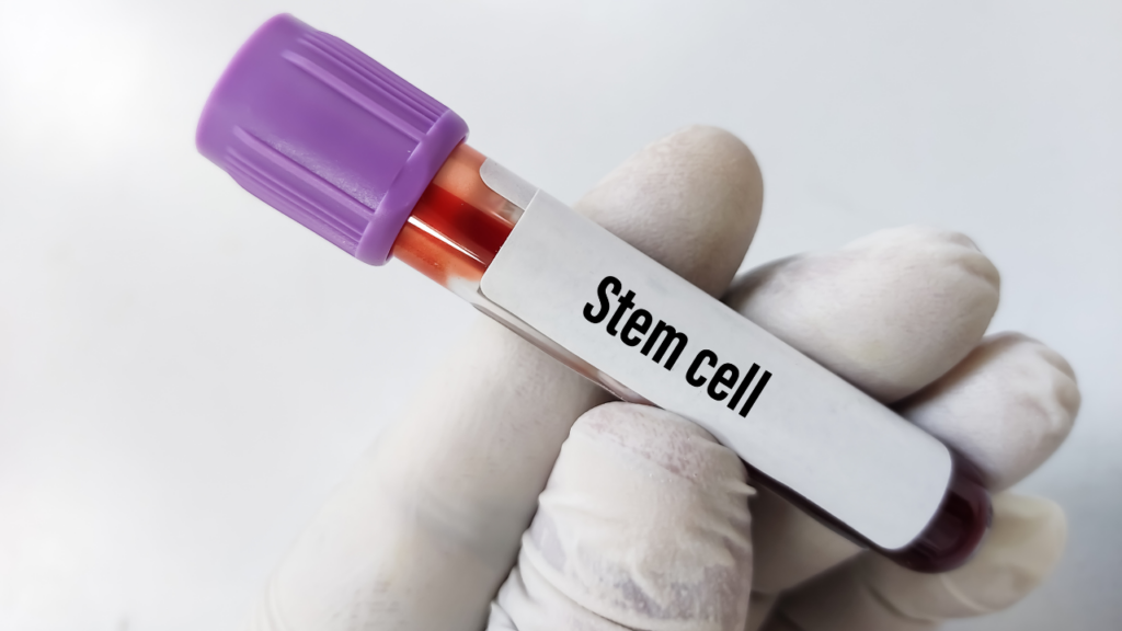 stem cell therapy