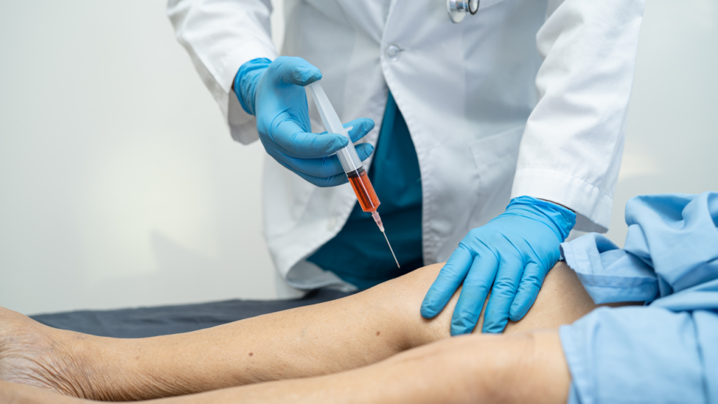 stem cell therapy