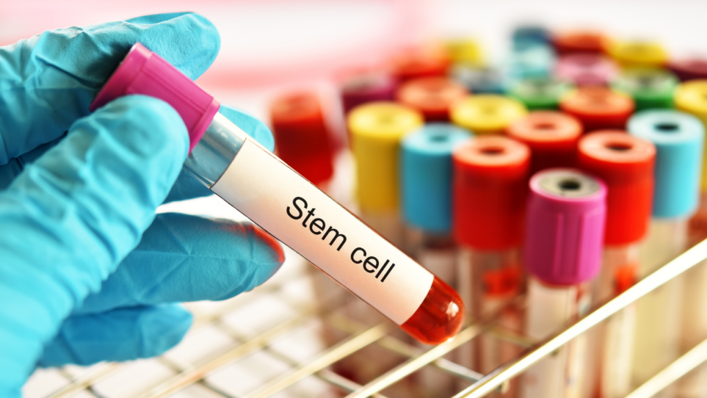 stem cell therapy