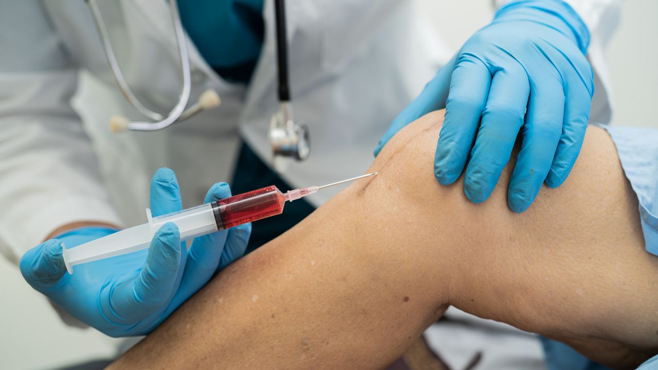 PRP therapy Riverside