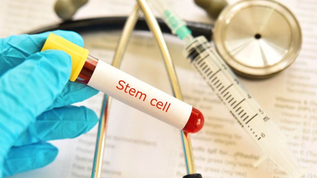 Stem cell therapy in Newport Beach