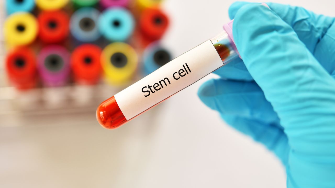 stem cell therapy Riverside