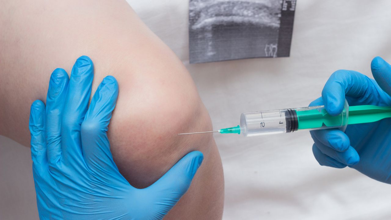 stem cell therapy
