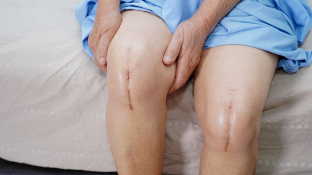 alternative surgery options