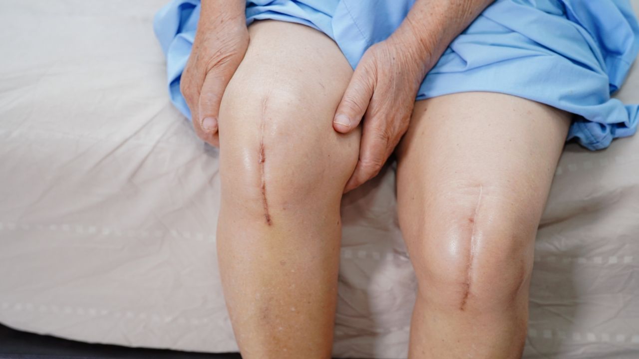 alternative surgery options