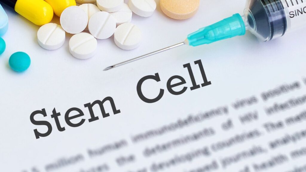 stem cell therapy Newport Beach