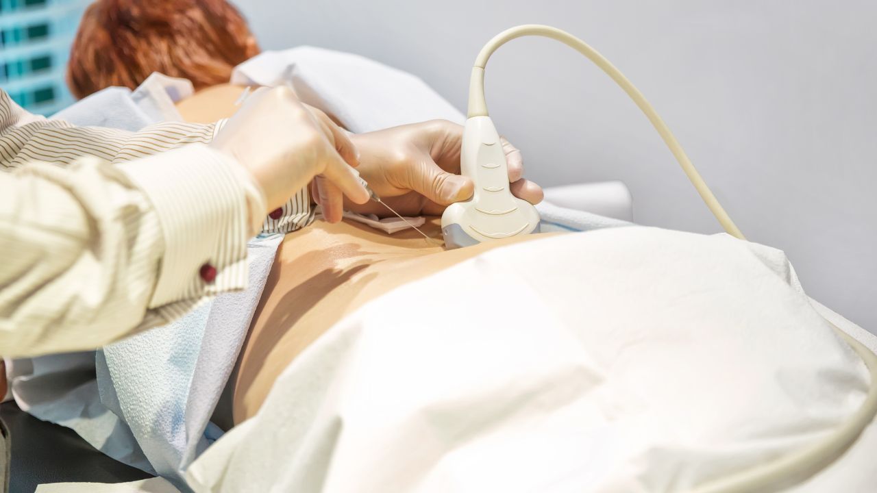 platelet-rich plasma