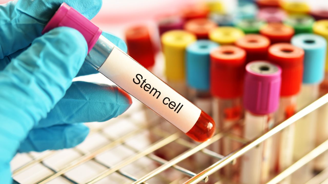 PRP vs stem cell therapy