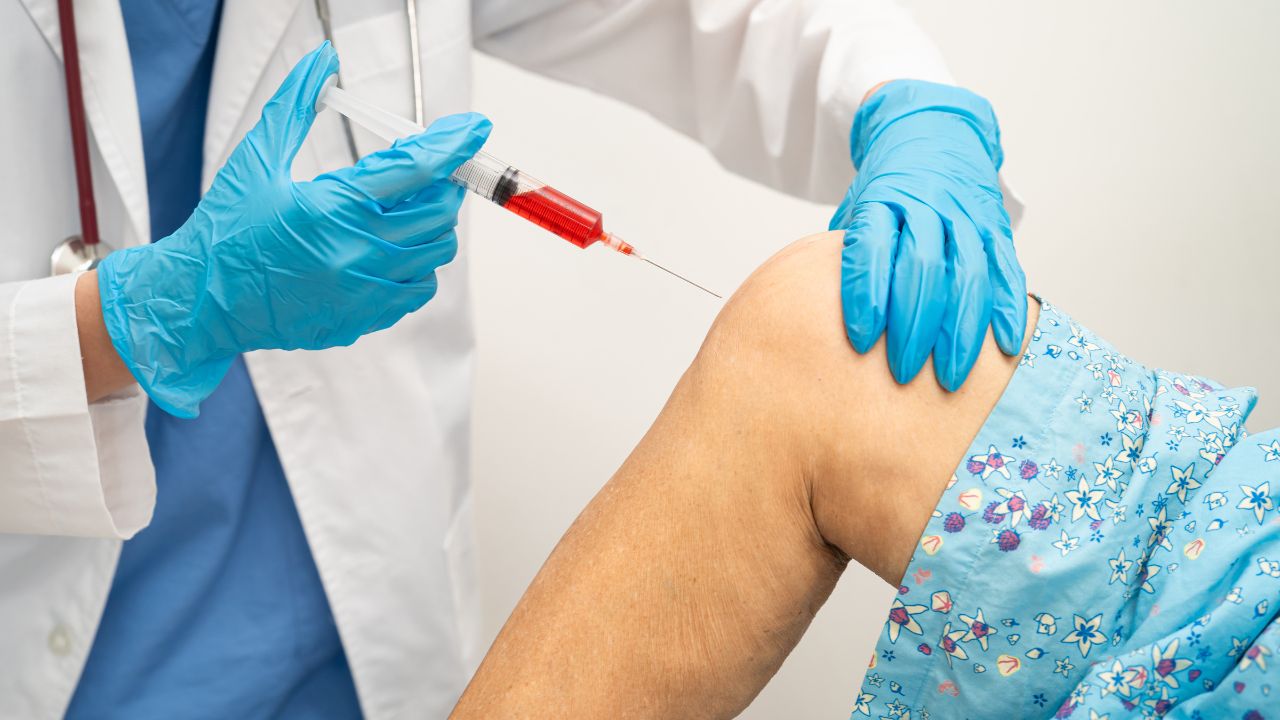 PRP delivers value for joint pain