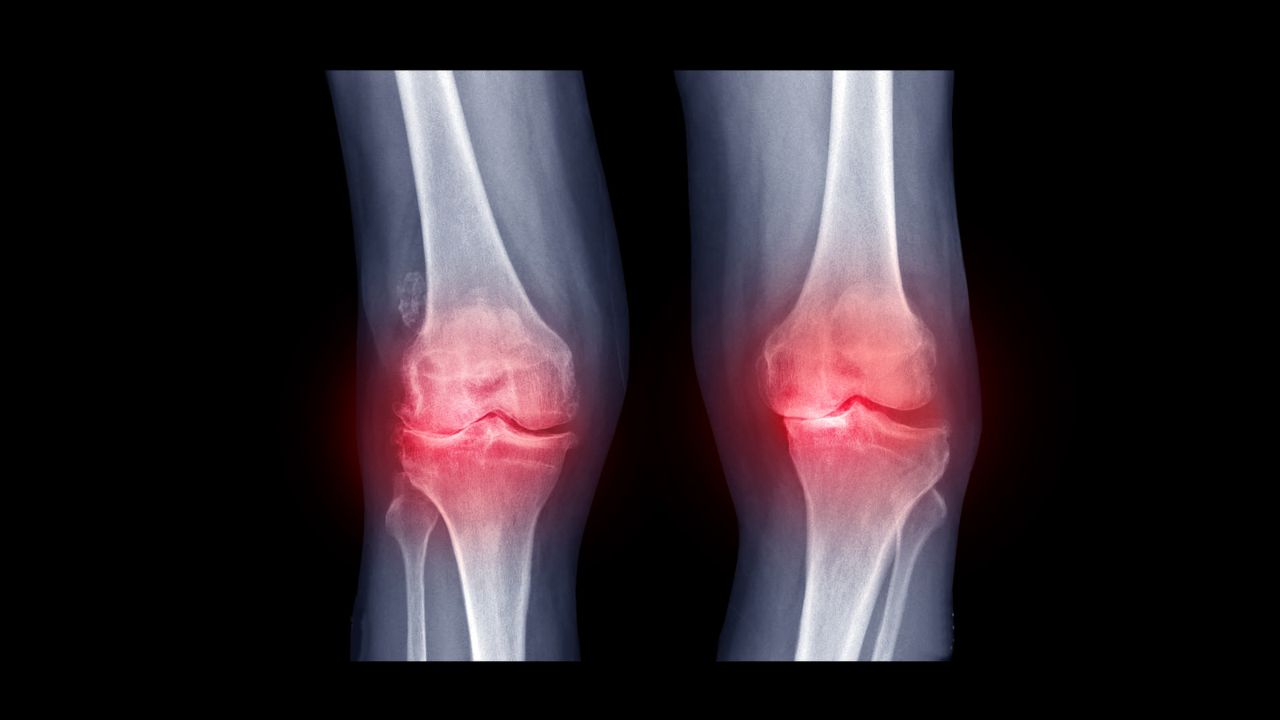 Stem cell therapy benefits