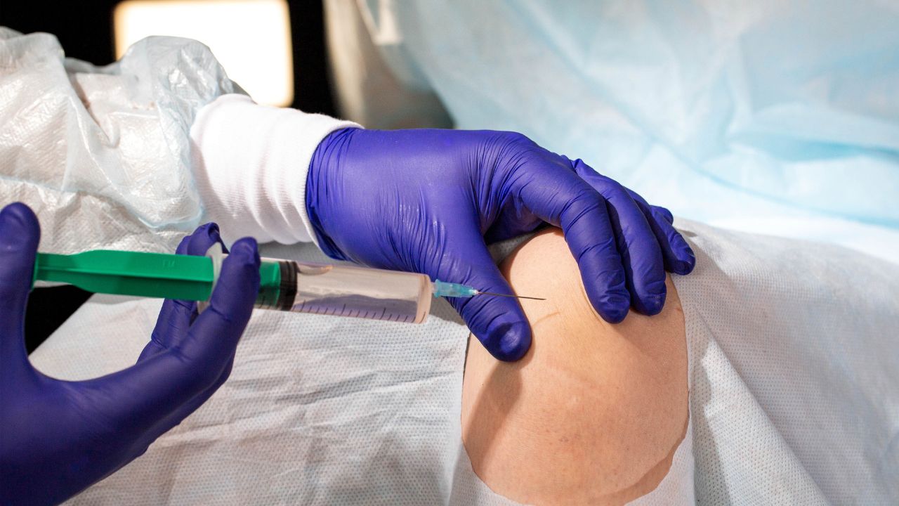 joint injection